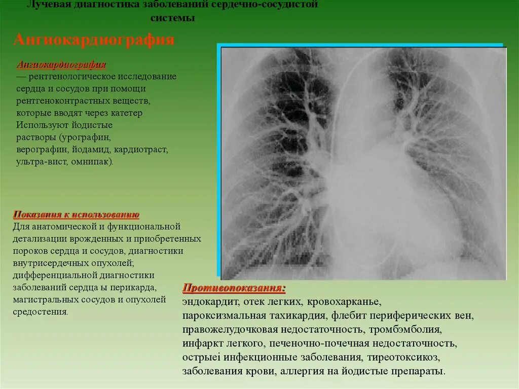 Лучевые заболевания легких. Лучевая диагностика заболеваний. Лучевая диагностика сердца. Лучевая диагностика заболеваний сердечно-сосудистой системы. Лучевые методы исследования сердца.