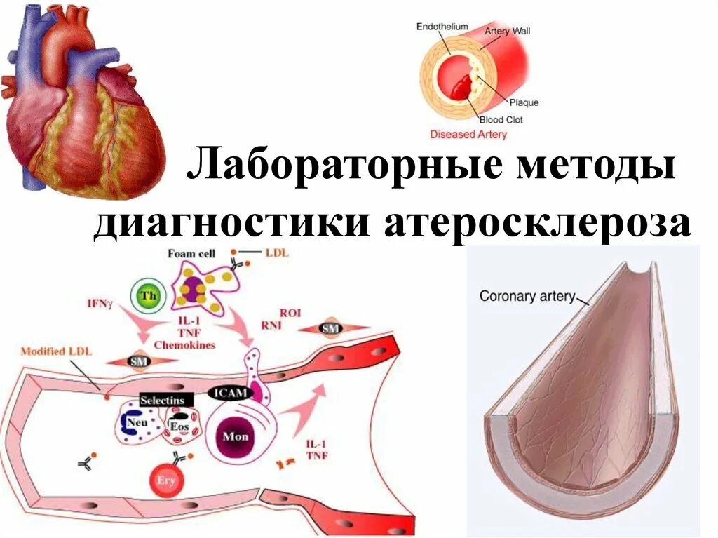 Атеросклероз какой врач. Лабораторные методы исследования при атеросклерозе. инструментальные методы исследования атеросклероза. лабораторная диагностика атеросклероза биохимия. инструментальные методы обследования при атеросклерозе.