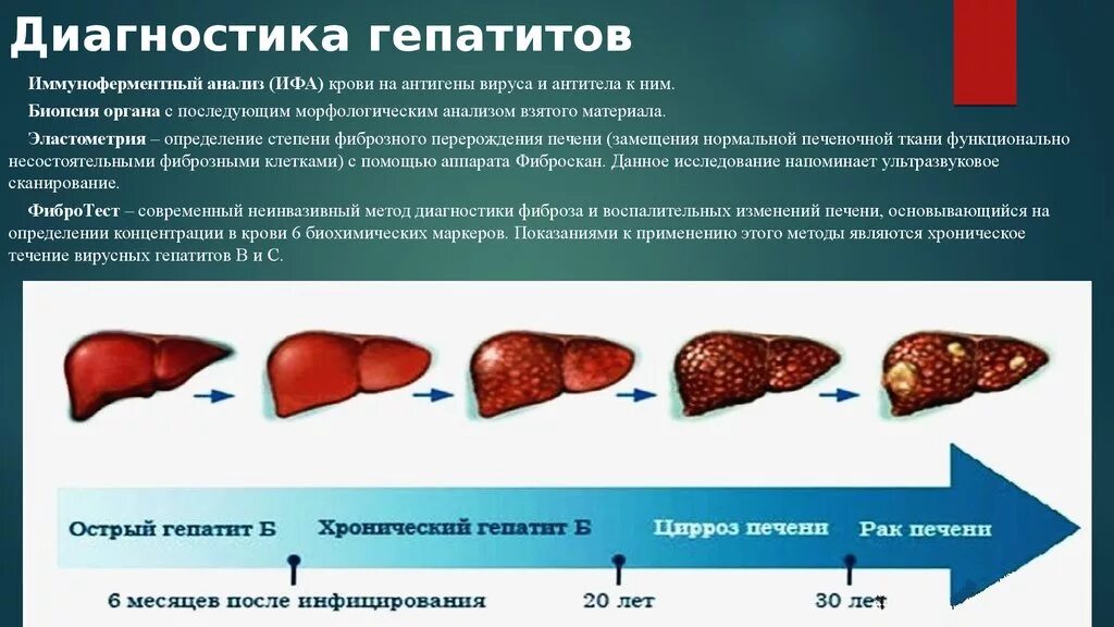 Вирусное поражение печени. Гепатит а поражение печени. Печень пораженная гепатитом. Гепатит б последствия