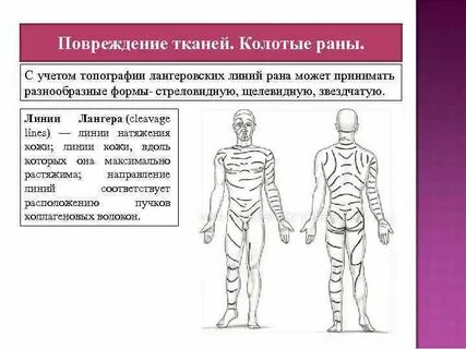 Линии лангера схемы