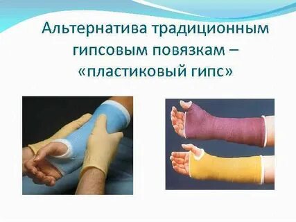 Техника гипса