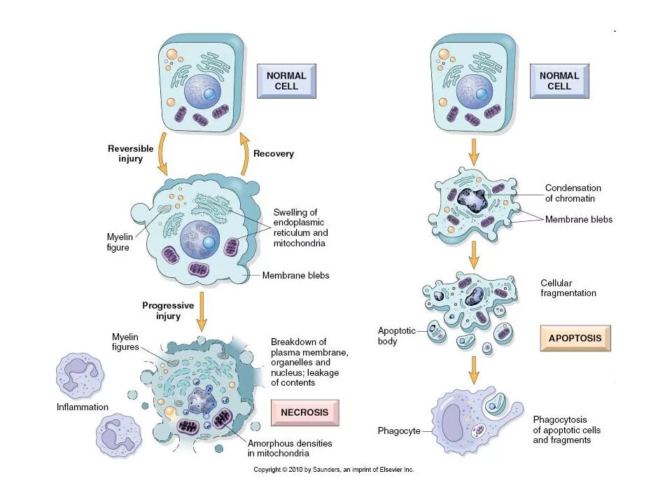 Апоптоз и некроз отличия. Апоптоз клетки схема. Апоптоз клетки стадии. Этапы апоптоза клетки. Необратимые изменения клетки