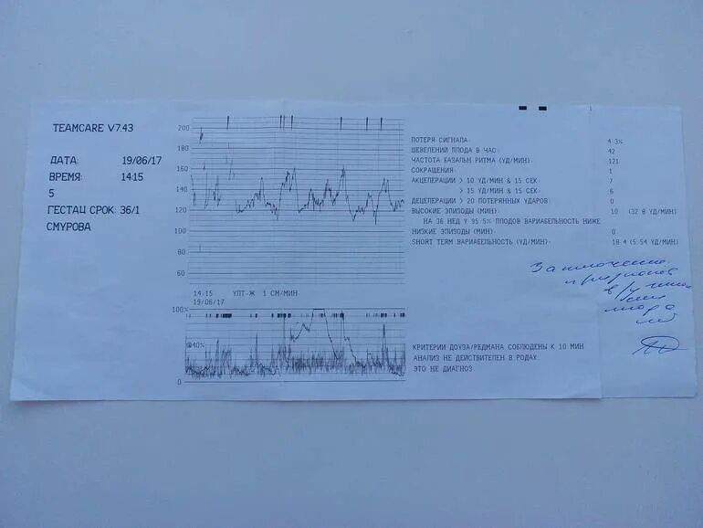 КТГ при беременности схватки расшифровка. КТГ расшифровка показателей схватки. КТГ при схватках расшифровка. КТГ В родах расшифровка. Схватки на 36 неделе
