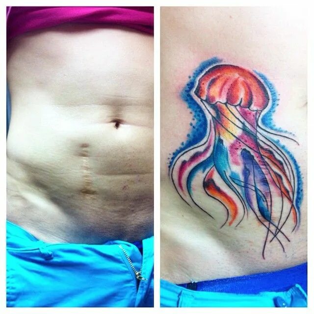 Тату медуза для девушек. Живот медузы. Татуировка подводный мир. Цирроз печени голова медузы. Голова медузы асцит на животе.