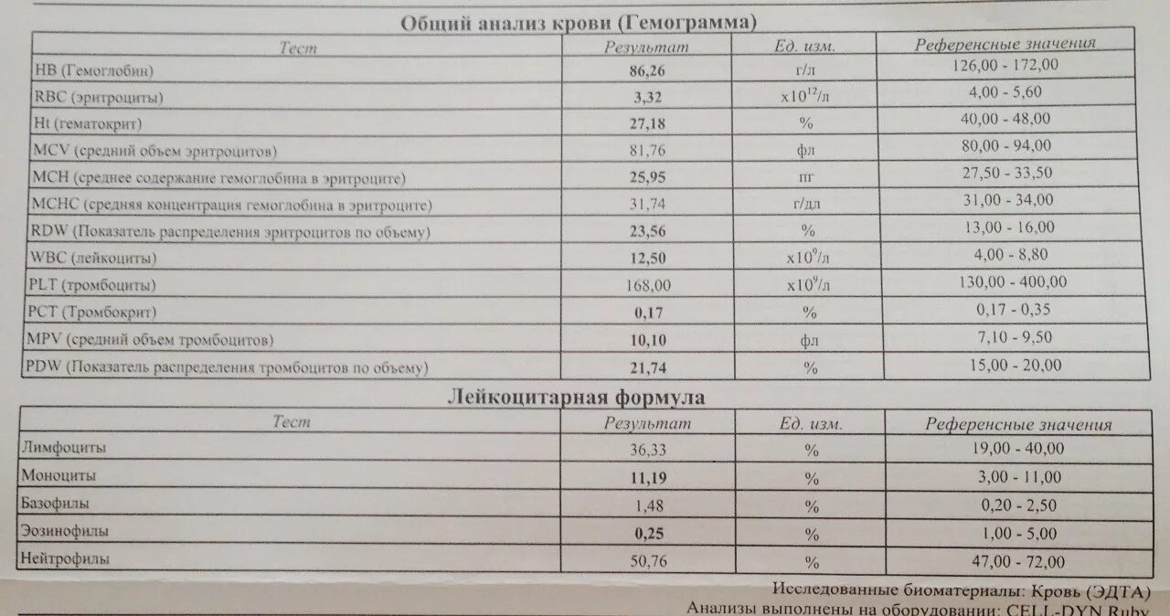 Гемоглобин ниже 50