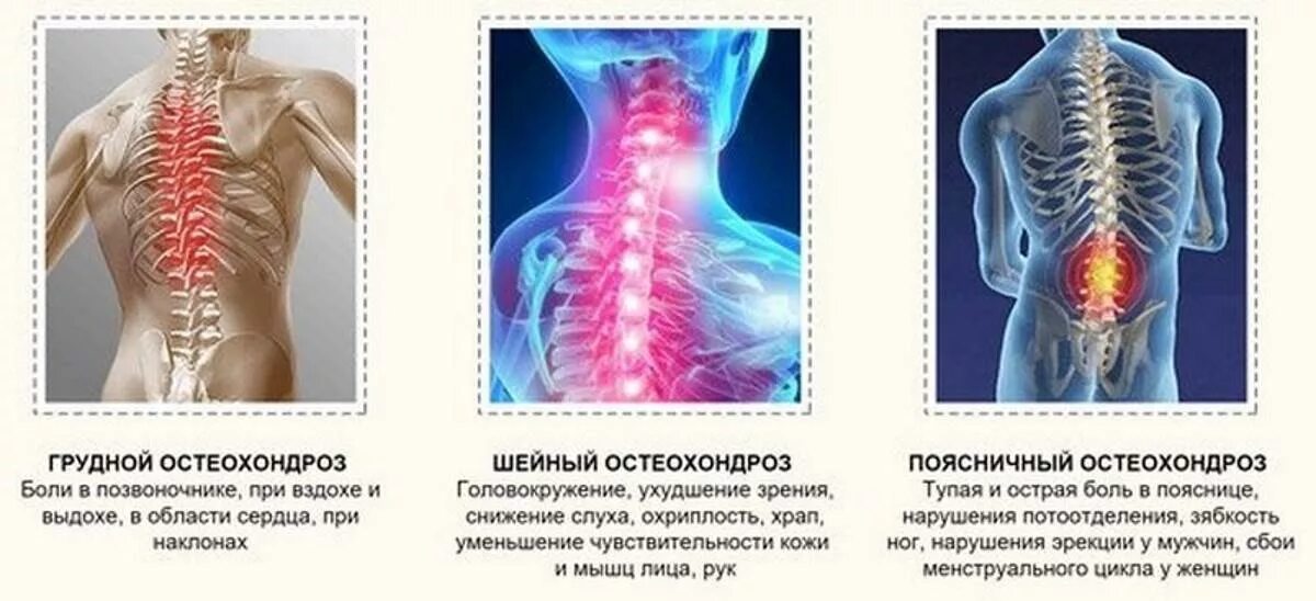 Болит кость позвоночника. Остеохондроз среднегрудного отдела позвоночника. Остеохондроз картинки. Остеохондроз шейный грудной поясничный.