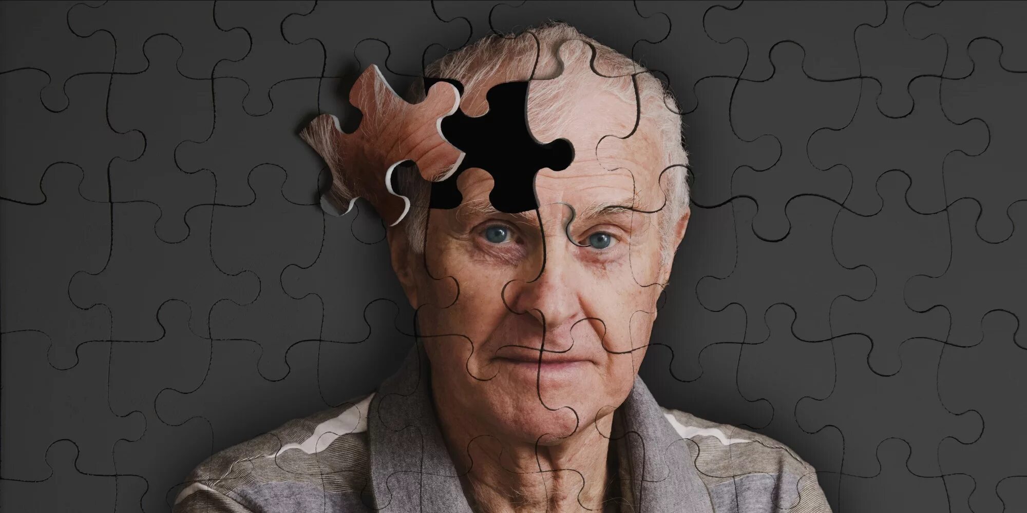 Деменции альцгеймеровского. Болезнь Альцгеймера деменция. Энн Вудс болезнь Альцгеймера. Старческое слабоумие.