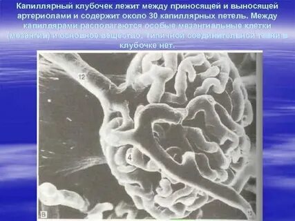 Капиллярный почечный клубочек