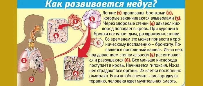 Начала задыхаться причины. Если кашель и тяжело дышать. Почему человек может задыхаться. После кашля трудно дышать что это. Тяжелое дыхание кашель.