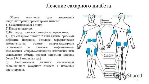 Типа куда