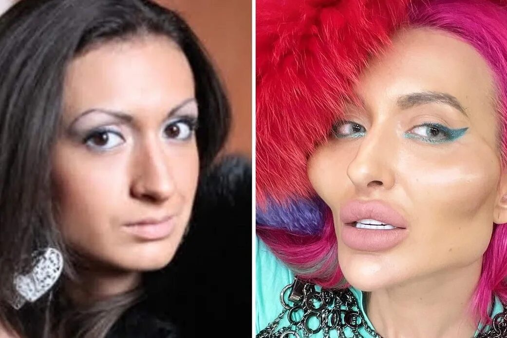 анастасия покрещук до пластики. анастасия джаст квин. модель анастасия покрищук. анастасия покрищук _just__queen. анастасия покрищук 2021.