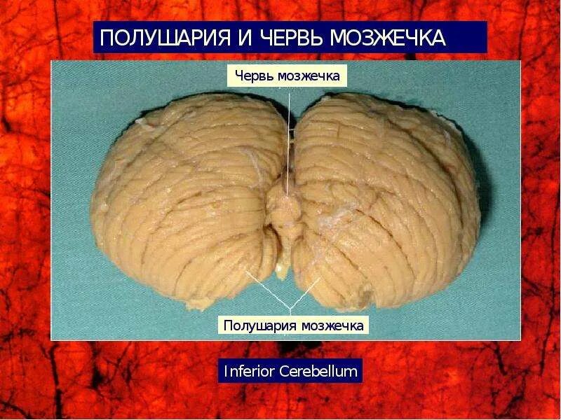 Ни клочка. Дольки червя мозжечка анатомия. Червь мозжечка анатомия. Строение червя мозжечка анатомия. Ни клочка.