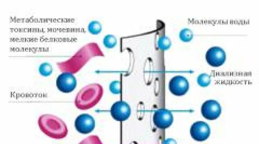 Диализ белков. Диализ - это процесс мембранной фильтрации. Аппарат для гемодиализа схема. Схема диализа крови. Диализ принцип действия.