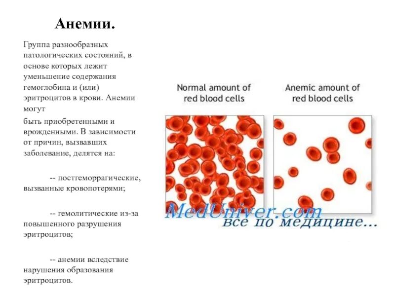 Анемия это заболевание крови. Анемия вследствие кровопотери. Анемия железодефицитная эритроциты в крови. Анемия эритроциты и гемоглобин. Снижены эритроциты и гемоглобин.