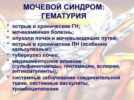 Гематурия наблюдается при