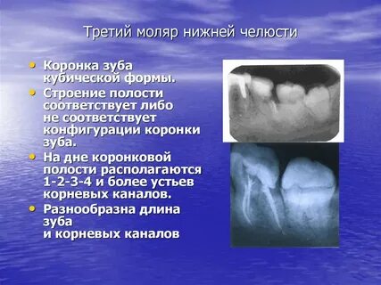 Анатомия моляров нижней челюсти