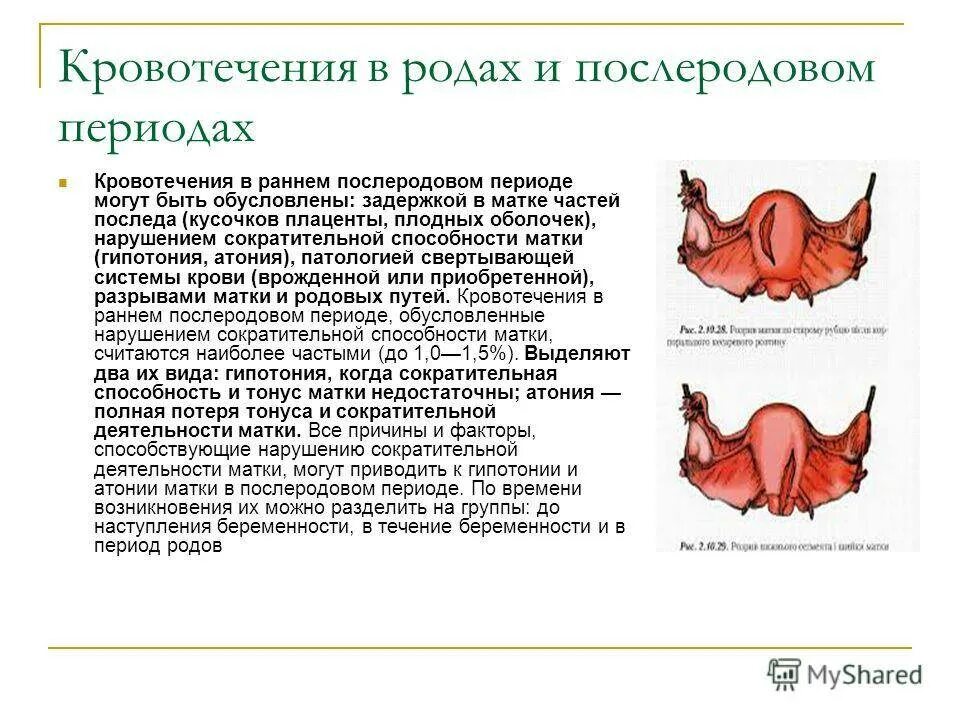 Кровь при схватках