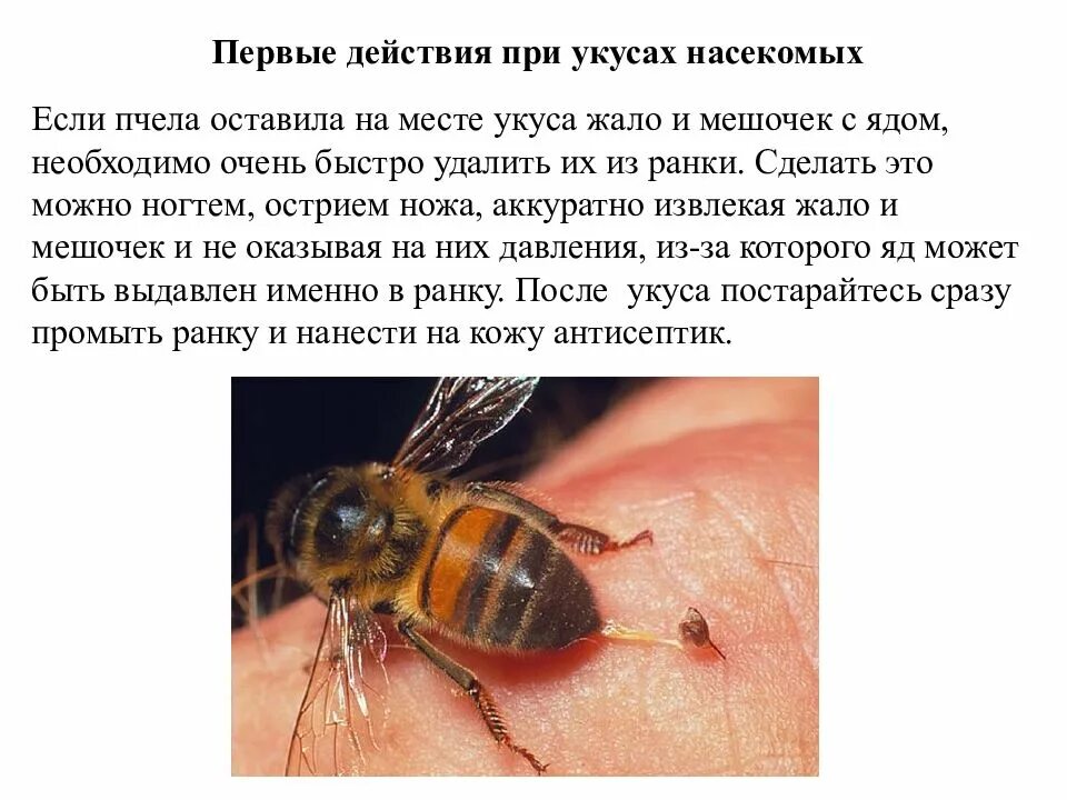 Что делать если в палец укусила оса. Шмель пчела оса шершень. Что делать если в палец укусила оса. Что делать если в палец укусила оса. Оказание помощи при укусе пчелы.