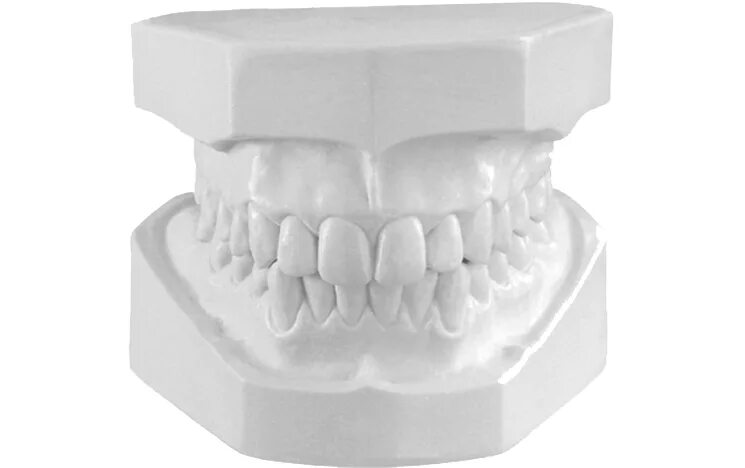Гипсовые модели челюстей. Гипсовые модели челюстей. Диагностические модели челюстей. Гипсовые модели челюстей. Гипсовые модели челюстей.