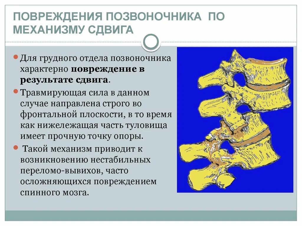 Повреждения позвоночника переломы. Механизм перелома позвоночника. Механизмы повреждения позвоночника. Поврежденияпозвоночник. Механизмы травмы позвоночника.