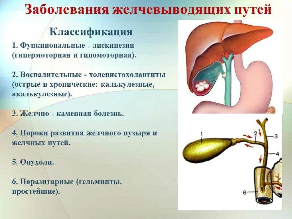 Признаки жкб. Болезни желчных путей классификация. Болезни желчного пузыря патология. Факторы желчнокаменной болезни. Классификация заболеваний желчного пузыря и желчных протоков.