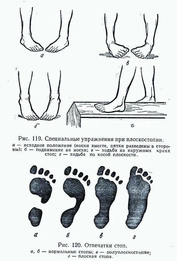 Массаж при плоскостопии у детей. Упражнения при вальгусной деформации стопы у детей 7 лет. лфк при вальгусной деформации стопы у детей. гимнастика при вальгусе стопы у детей 4. упражнения для стопы при вальгусной деформации у детей картинки.