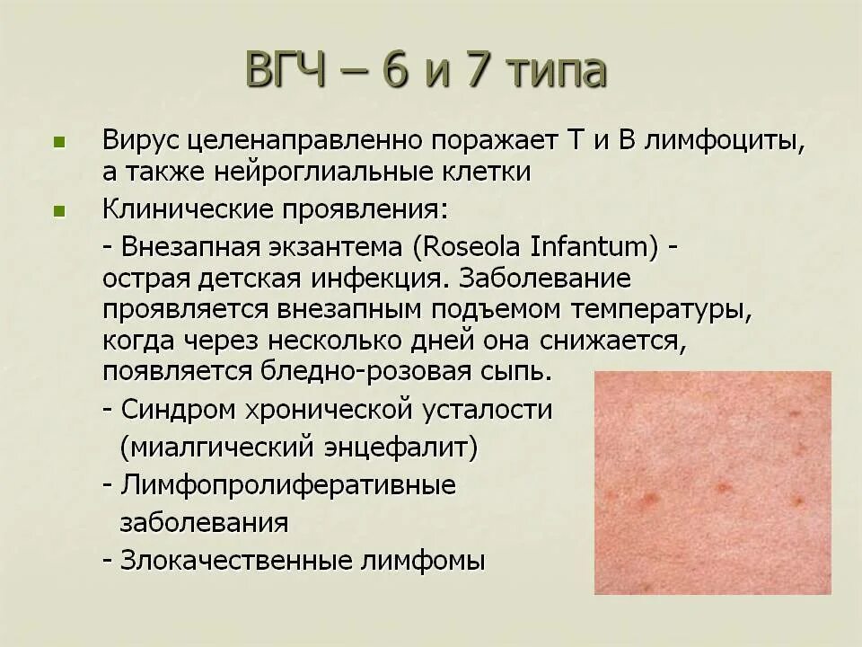 Herpes virus 6. Паппулезная сыпь у детей. Герпесные высыпания на коже. Герметическая сыпь у детей.