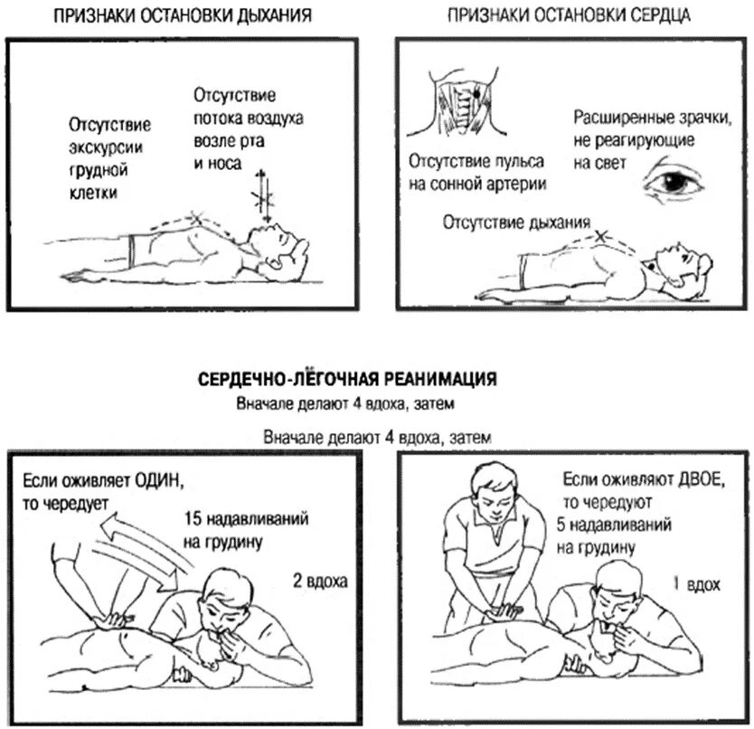 Алгоритм оказания первой помощи при остановке дыхания. Памятка первая помощь при остановке дыхания 8 класс. 1 Помощь при остановке дыхания и кровообращения. Признаки остановки дыхания. Перестаю дышать текст