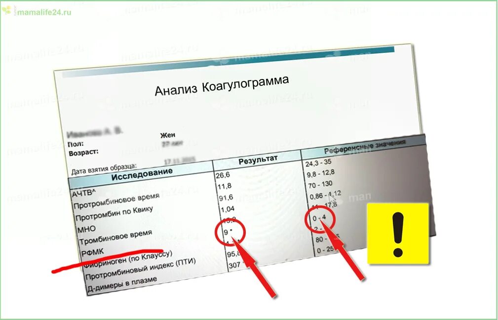 Повышены рфмк при беременности. Растворимые фибрин-мономерные комплексы (рфмк). фибрин мономерные комплексы норма. рфмк анализ крови что это. рфмк анализ крови норма.