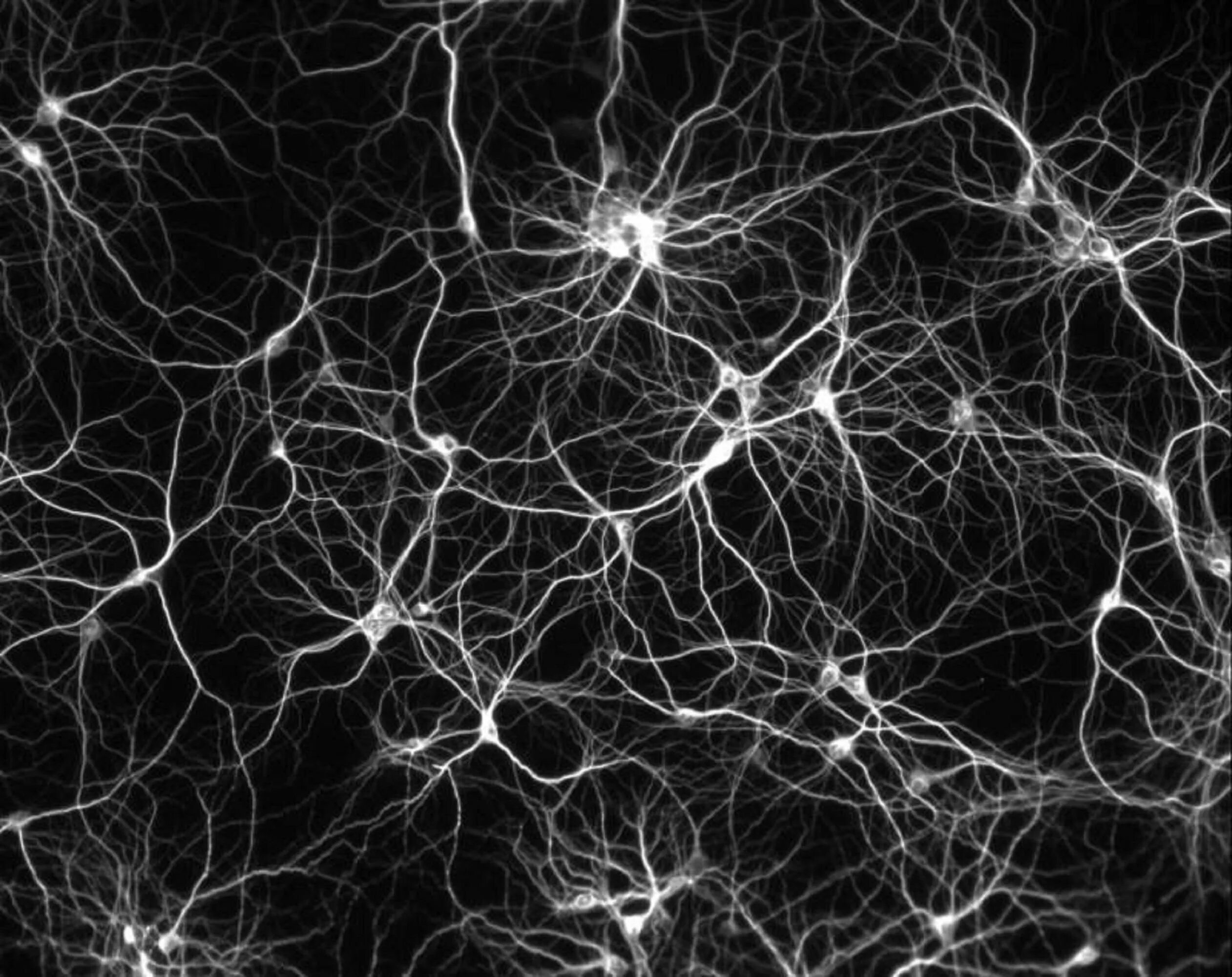 Сеть нейронов. Нейронные нити. Нейроны мозга. Нейронные связи в мозге.