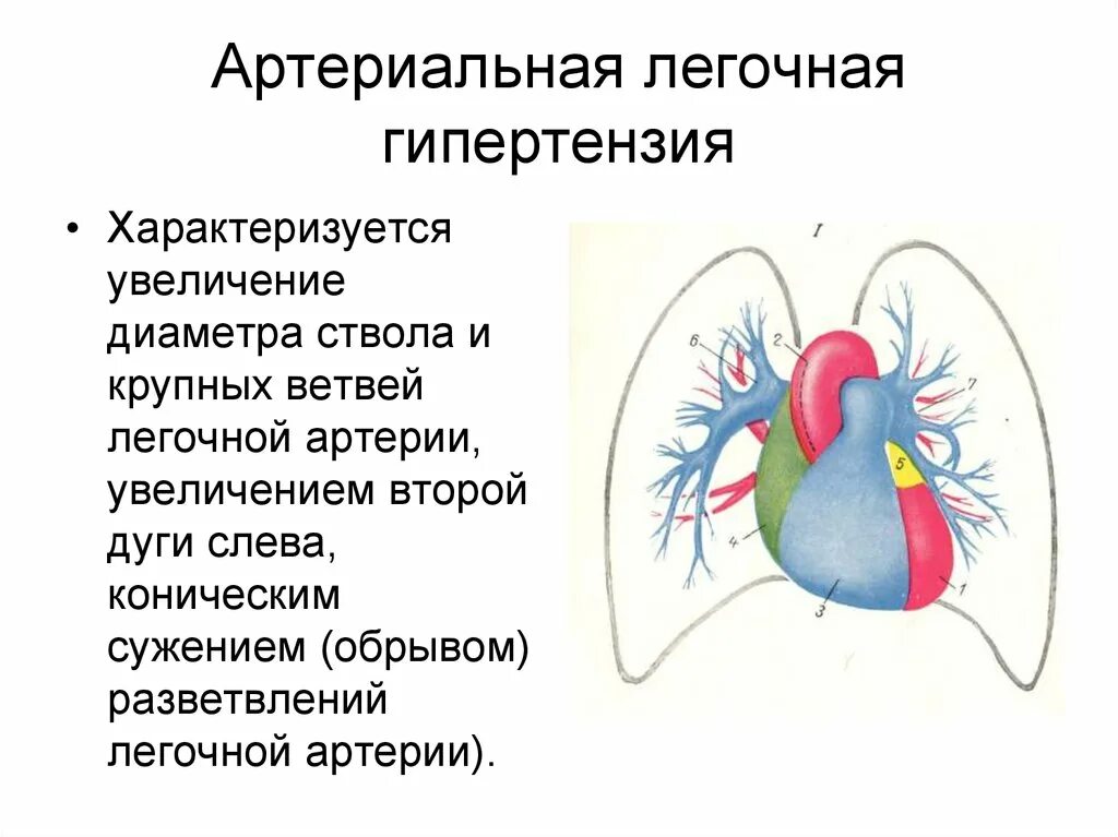 Легочная гипертензия. Легочная артериальная гипертензия. Что такое легочная гипертензия сердца. Гипертензия легких.