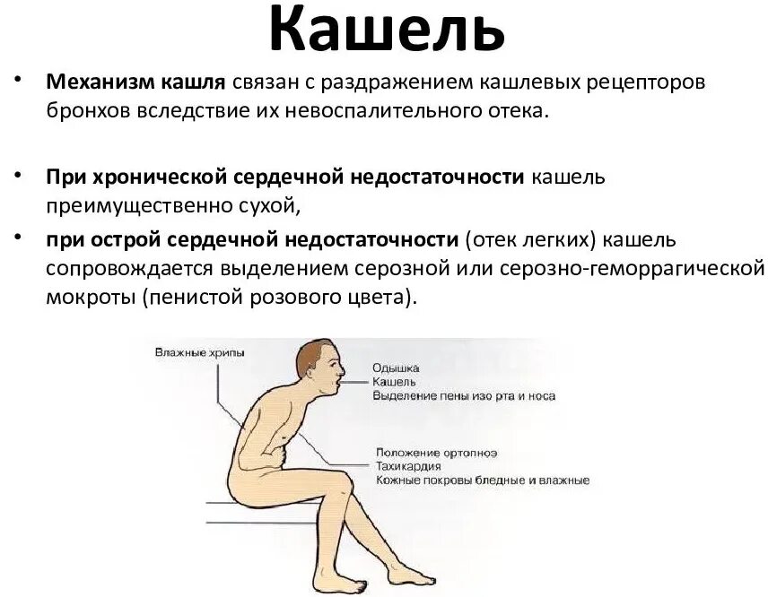 Сердце кашель мокрота. Кашель при сердечной недостаточности. Механизм кашля при сердечной недостаточности. Сердечная недостаточность кашель. Покашливание при сердечной недостаточности симптомы.