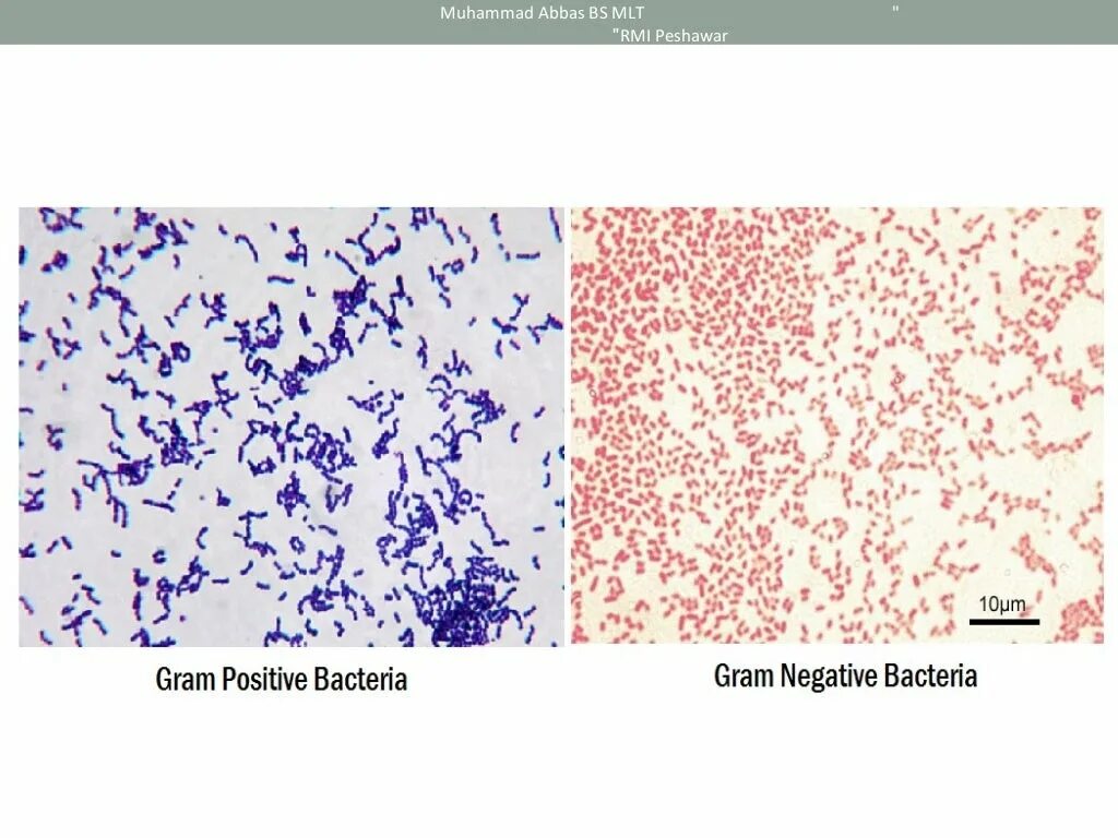 Грамотрицательные бактерии по граму. Грамм отрицательные микроорганизмы окрашиваются в. Грамположительные бактерии палочки. Окраска грамм отрицательные бактерии. Грамотрицательные спорообразующие бактерии.