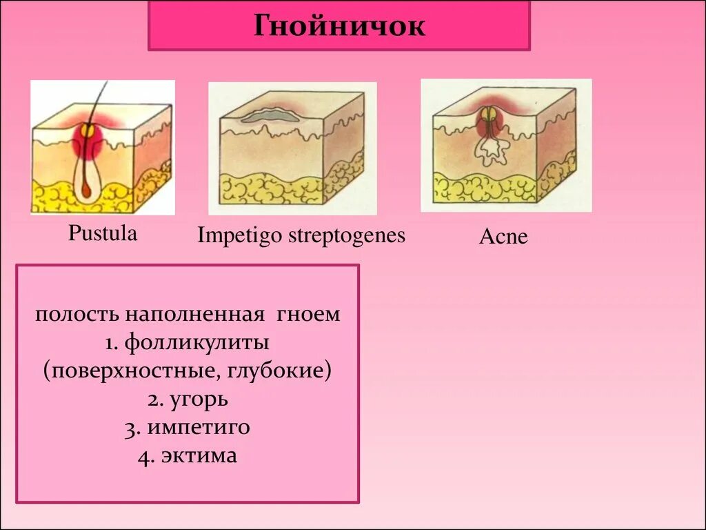 Слизистые покровы или гладкая поверхность. Гнойничок дерматология. Гнойничок Дерматовенерология.