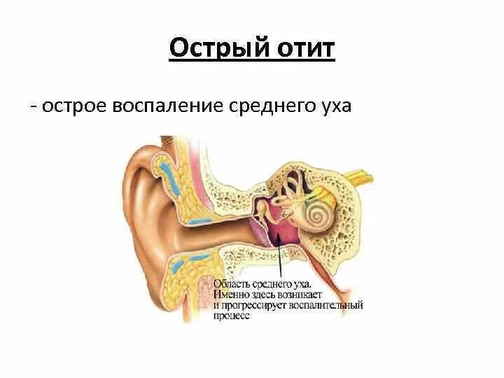 Строение уха и средний отит. Острый наружный средний отит. Строение уха человека схема отит. Воспаление внутреннего уха лечение