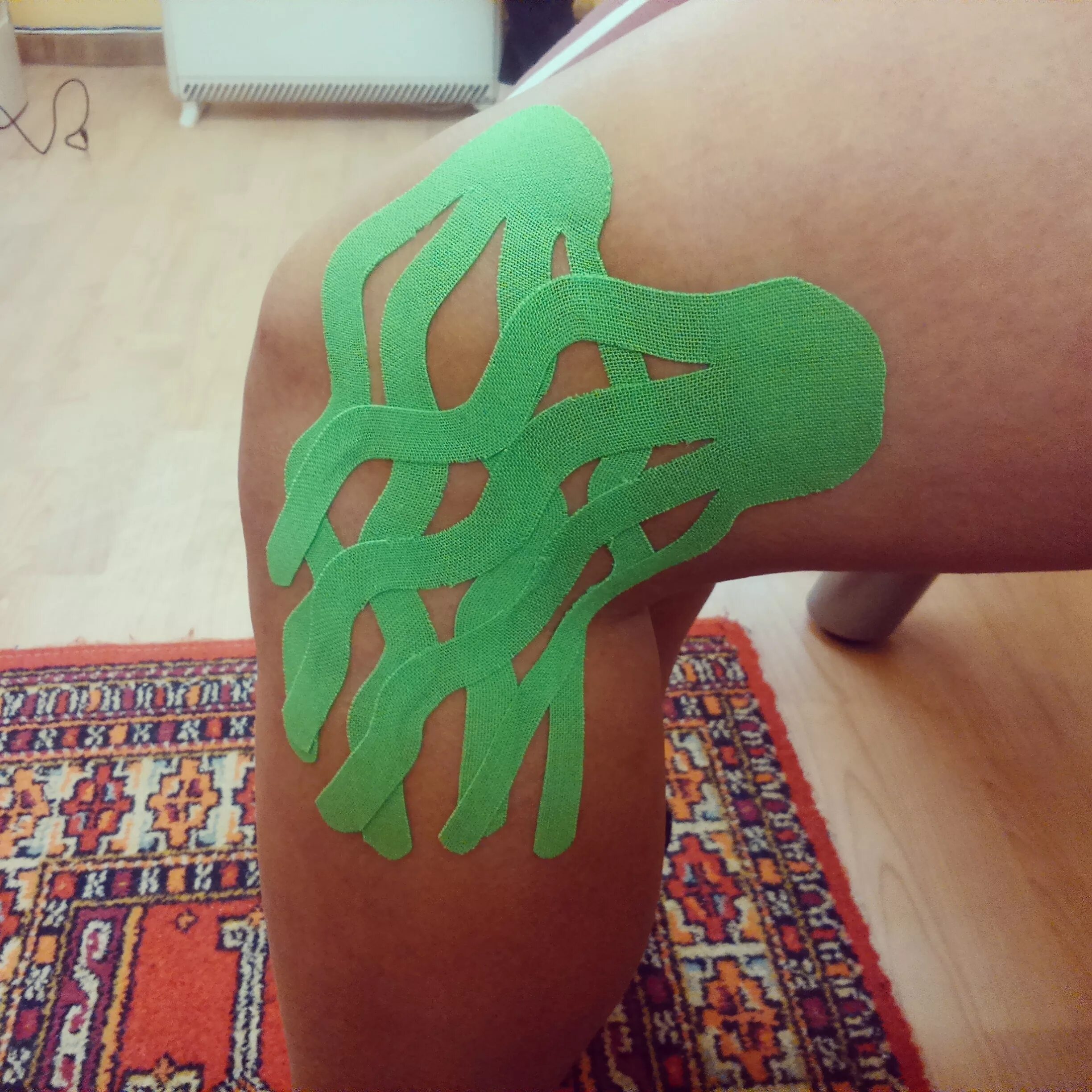 аппликация тейпирование аппликация. основные виды аппликаций тейпов. виды аппликаций тейпирования. схемы аппликации тейпов. I-образный тейп.