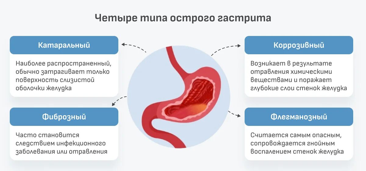 Атрофический гастрит симптомы и лечение у взрослых. Морфологические формы острого гастрита. Осложнения острого гастрита. Памятка пациенту с острым гастритом.