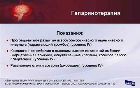 Тромболизис при ишемическом инсульте