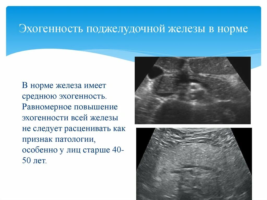 Эхогенность печени понижена. Эхогенность предстательной железы на УЗИ. Поджелудочная железа повышенной эхогенности. Повышена эхогенность поджелудочной железы на УЗИ. УЗИ картина поджелудочной железы в норме.