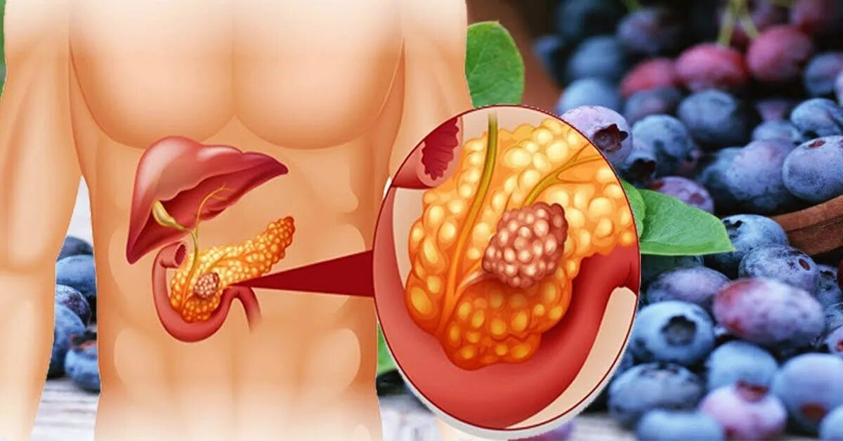 Фрукты для поджелудочной железы. Здоровье поджелудочной железы. Здоровая поджелудочная железа продукты.