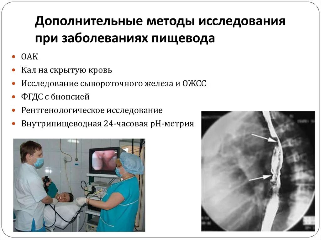 Осмотр пищевода. Методы исследования пищевода. Исследования при заболеваниях пищевода. Методы исследования заболеваний пищевода. Методы исследования при патологии пищевода.