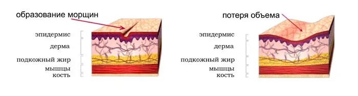 Почему образовываются складки. Образование морщин. Формирование морщин. Как образуются морщины. Как формируются морщины.