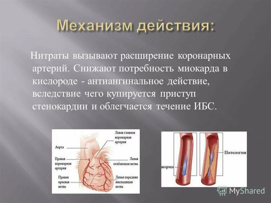 Расширение коронарных сосудов вызывает. Лекарство для расширения коронарных артерий. Для расширения коронарных артерий применяется. Средства расширяющие коронарные сосуды. Расширяет коронарные сосуды