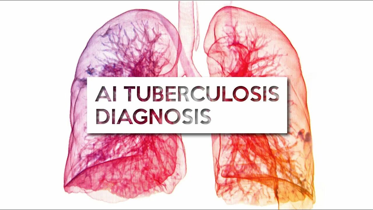 Туберкулез 2019. Tuberculosis diagnosis.