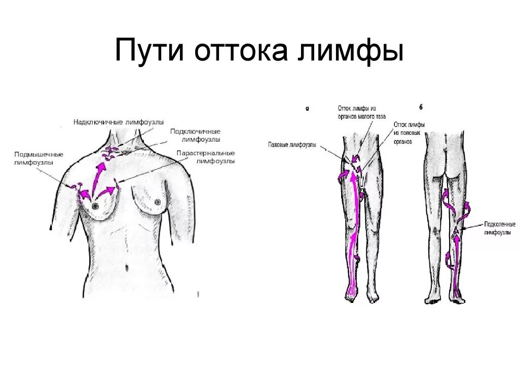 Схема лимфы лимфоузлы на теле. Подключичные лимфоузлы расположение схема. Лимфа массаж схема. Схема массажа лимфатических узлов. Лимфоузел после массажа