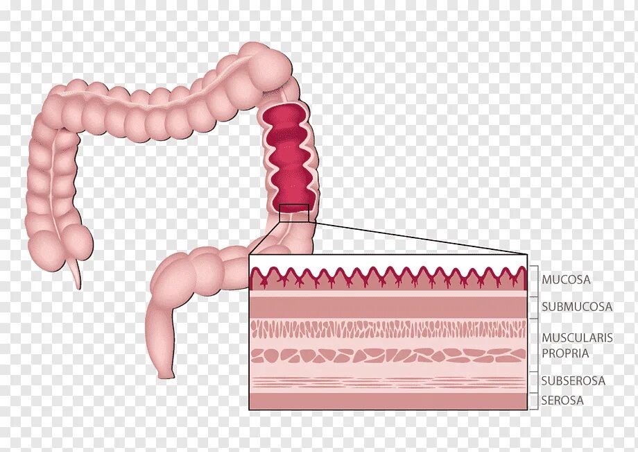 Слизистый слой кишки. Слои Толстого кишечника. Стенки толстой кишки анатомия. Тонкий и толстый кишечник.