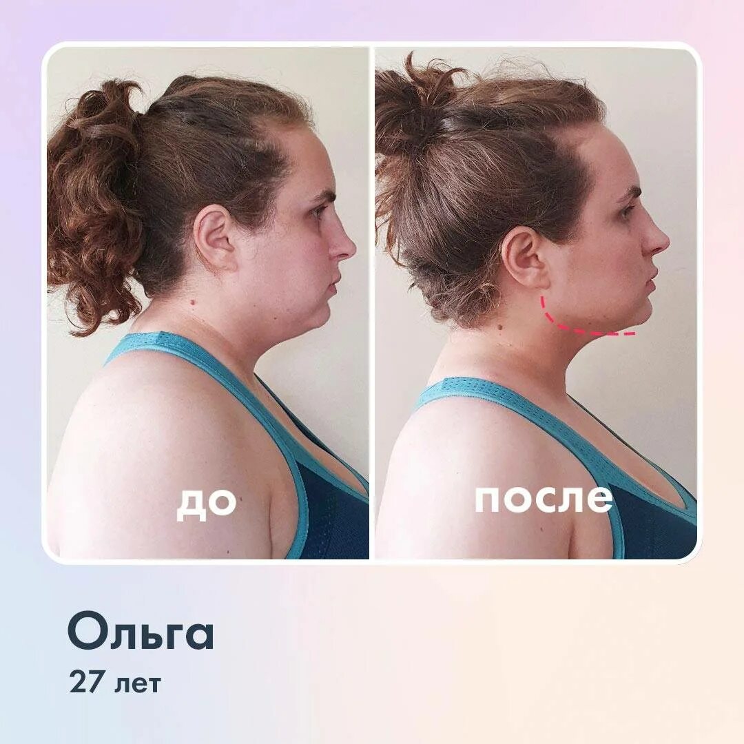 Как убрать 2 подбородок. Второй подбородок. упражнения от второго подбородка. упражнения от второго подбородка до и после. второй подбородок до и после упражнений.