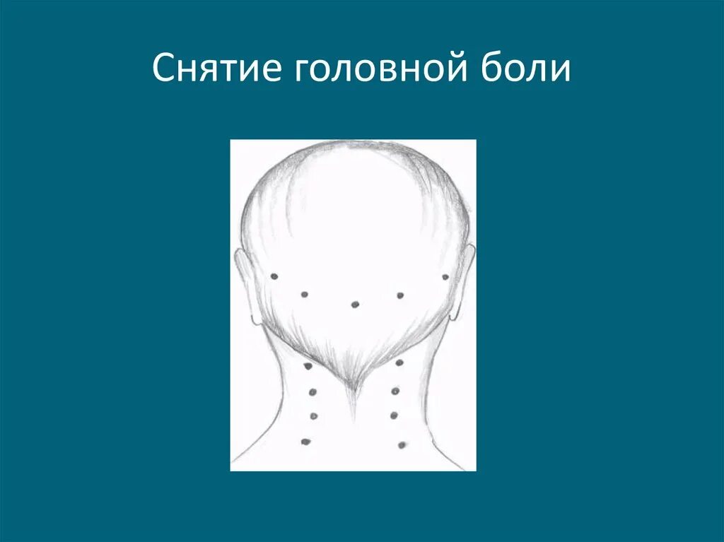 Упражнения при головной боли. Медитация от головной боли. Музыка для снятия головной боли. Точки верх низ на голове саморегуляция. Бинауральная голова.