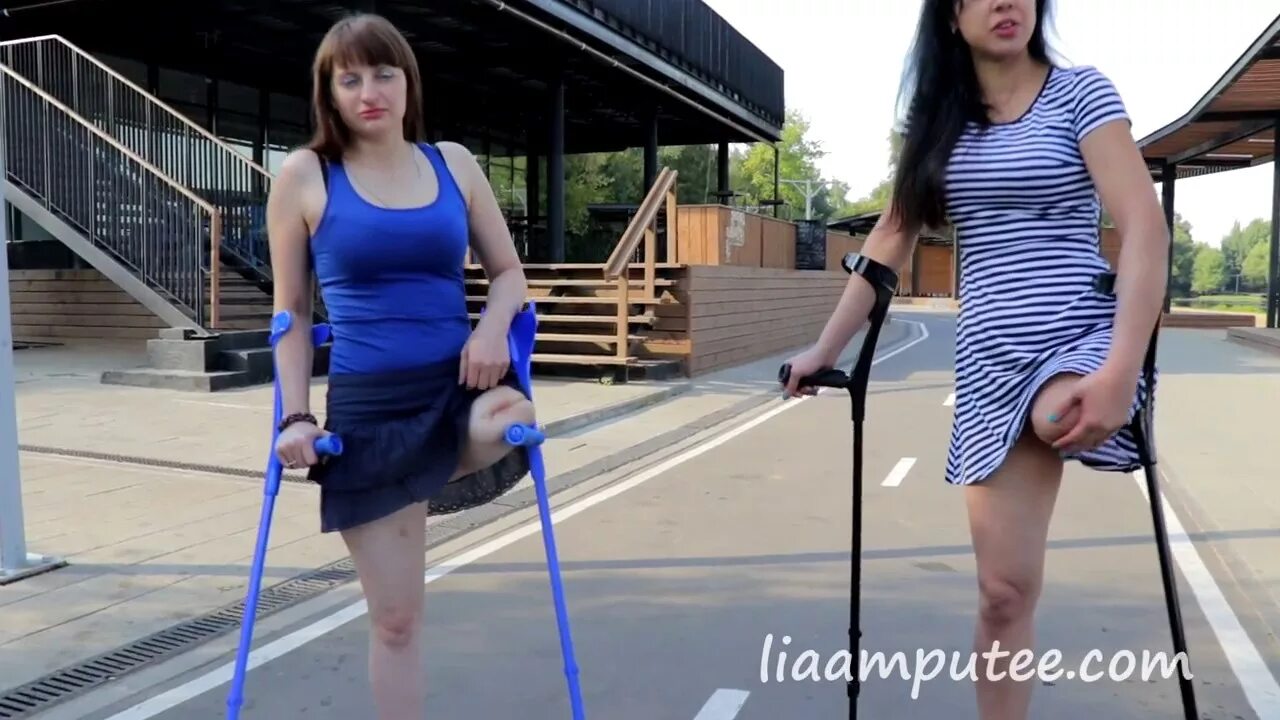 Amputee girl video. Анастасия ампути. Ольга пожидаева ампути липецк. Крылова amputee. Владлена прохорова ампути.