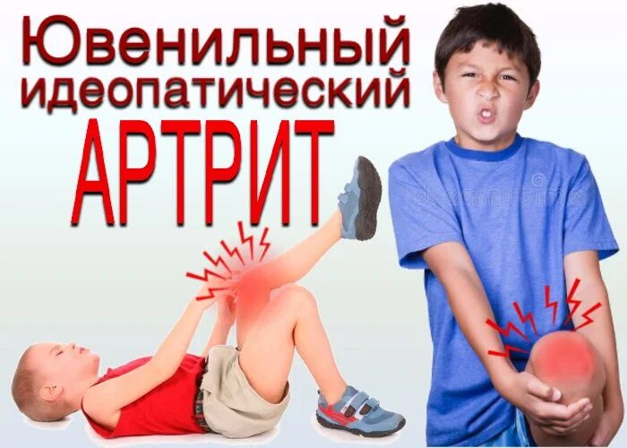 Ювенильный артрит форум. Суставные формы ювенильного ревматоидного артрита. Юношеский полиартрит серонегативный. Ювенильный ревматоидный артрит. Системный ювенильный ревматоидный артрит.